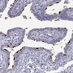 Immunohistochemical staining of human fallopian tube shows high expression.