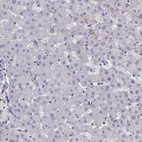 Immunohistochemical staining of human liver shows low expression as expected.