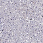 Anti-STOML3 Antibody