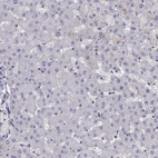 Immunohistochemical staining of human liver shows low expression as expected.