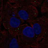 Anti-NTS Antibody