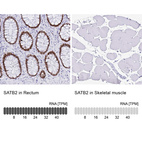 Anti-SATB2 Antibody