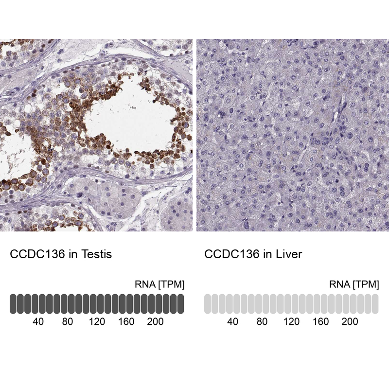 Anti-CCDC136 Antibody