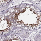 Immunohistochemical staining of human testis shows strong cytoplasmic positivity in spermatids and spermatocytes in cells in seminiferous ducts.