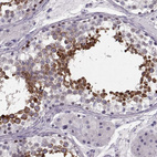 Anti-CCDC136 Antibody