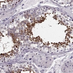 Immunohistochemical staining of human testis shows strong cytoplasmic positivity in spermatids and spermatocytes in cells in seminiferous ducts.