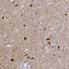 Immunohistochemical staining of human cerebral cortex shows strong cytoplasmic positivity in neuronal cells.