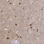 Immunohistochemical staining of human cerebral cortex shows strong cytoplasmic positivity in neuronal cells.