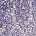 Immunohistochemical staining of human duodenum shows no cytoplasmic positivity in glandular cells as expected.