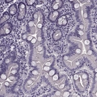 Immunohistochemical staining of human duodenum shows no cytoplasmic positivity in glandular cells as expected.