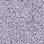 Anti-CCDC136 Antibody