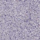 Immunohistochemical staining of human liver shows no cytoplasmic positivity in hepatocytes as expected.