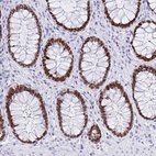 Anti-SATB2 Antibody