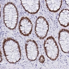 Immunohistochemical staining of human rectum shows strong nuclear positivity in glandular cells.
