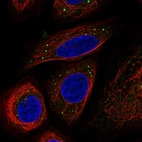 Immunofluorescent staining of human cell line SiHa shows localization to vesicles.