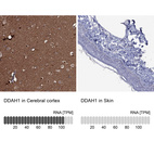 Anti-DDAH1 Antibody