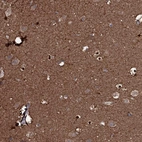 Immunohistochemical staining of human cerebral cortex shows strong cytoplasmic positivity in neuronal cells and neuropils.