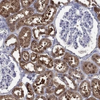 Immunohistochemical staining of human kidney shows strong cytoplasmic positivity in cells in tubules.