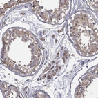 Immunohistochemical staining of human testis shows moderate cytoplasmic positivity in Leydig cells.