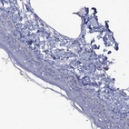 Immunohistochemical staining of human skin shows negative to very weak cytoplasmic positivity in squamous epithelial cells.