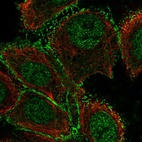 Anti-GALNT12 Antibody