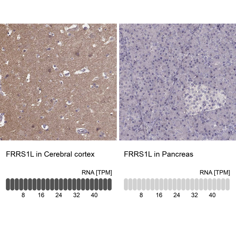 Anti-FRRS1L Antibody