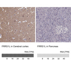 Anti-FRRS1L Antibody