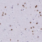 Anti-SATB2 Antibody