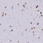 Immunohistochemical staining of human cerebral cortex shows strong nuclear positivity in neurons.