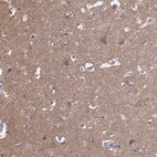Immunohistochemical staining of human cerebral cortex shows high expression.