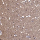 Anti-FRRS1L Antibody