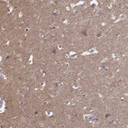 Immunohistochemical staining of human cerebral cortex shows high expression.