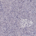 Anti-FRRS1L Antibody