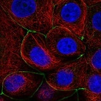 Anti-LNX1 Antibody