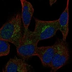 Anti-CGREF1 Antibody