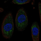 Immunofluorescent staining of human cell line RPTEC TERT1 shows localization to mitochondria.