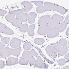 Anti-SATB2 Antibody