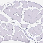 Immunohistochemical staining of human skeletal muscle shows no positivity in striated muscle fibers, as expected.