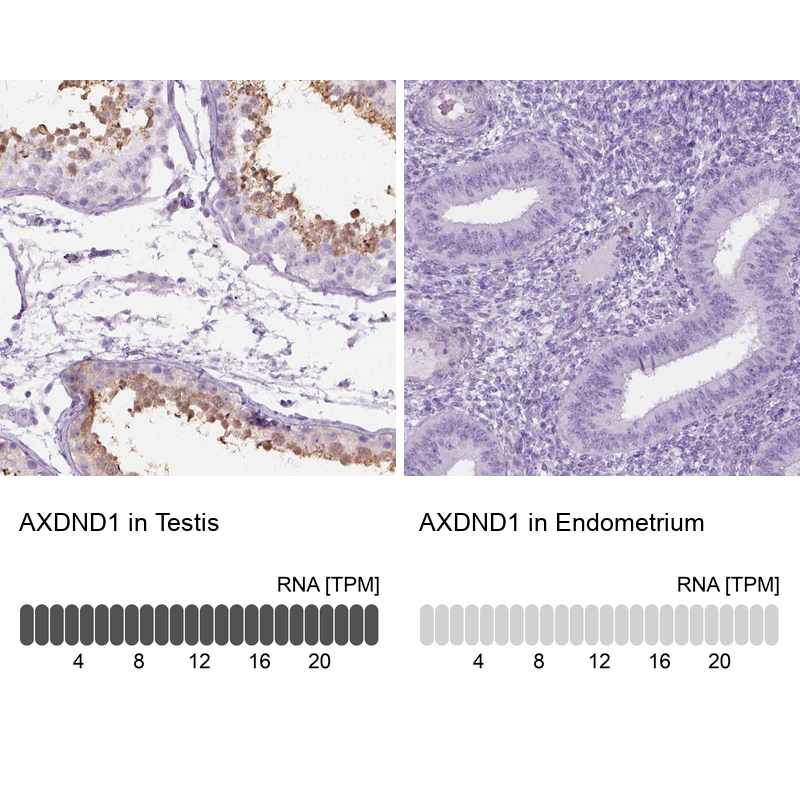 Anti-AXDND1 Antibody