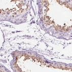 Immunohistochemical staining of human testis shows high expression.