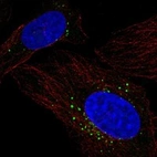 Immunofluorescent staining of human cell line U-2 OS shows localization to vesicles.