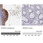 Anti-WFDC8 Antibody