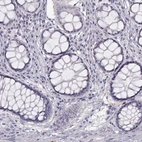 Immunohistochemical staining of human colon shows low expression as expected.