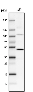 Western blot analysis in human cell line HEL.