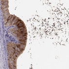 Immunohistochemical staining of human epididymis shows high expression.