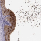 Immunohistochemical staining of human epididymis shows high expression.