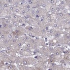 Immunohistochemical staining of human liver using Anti-WFDC8 antibody HPA071119.