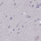 Immunohistochemical staining of human cerebral cortex using Anti-WFDC8 antibody HPA071119.