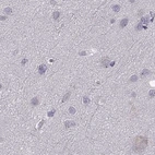 Immunohistochemical staining of human cerebral cortex using Anti-WFDC8 antibody HPA071119.