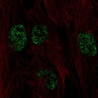 Immunofluorescent staining of human cell line BJ shows localization to nucleus.